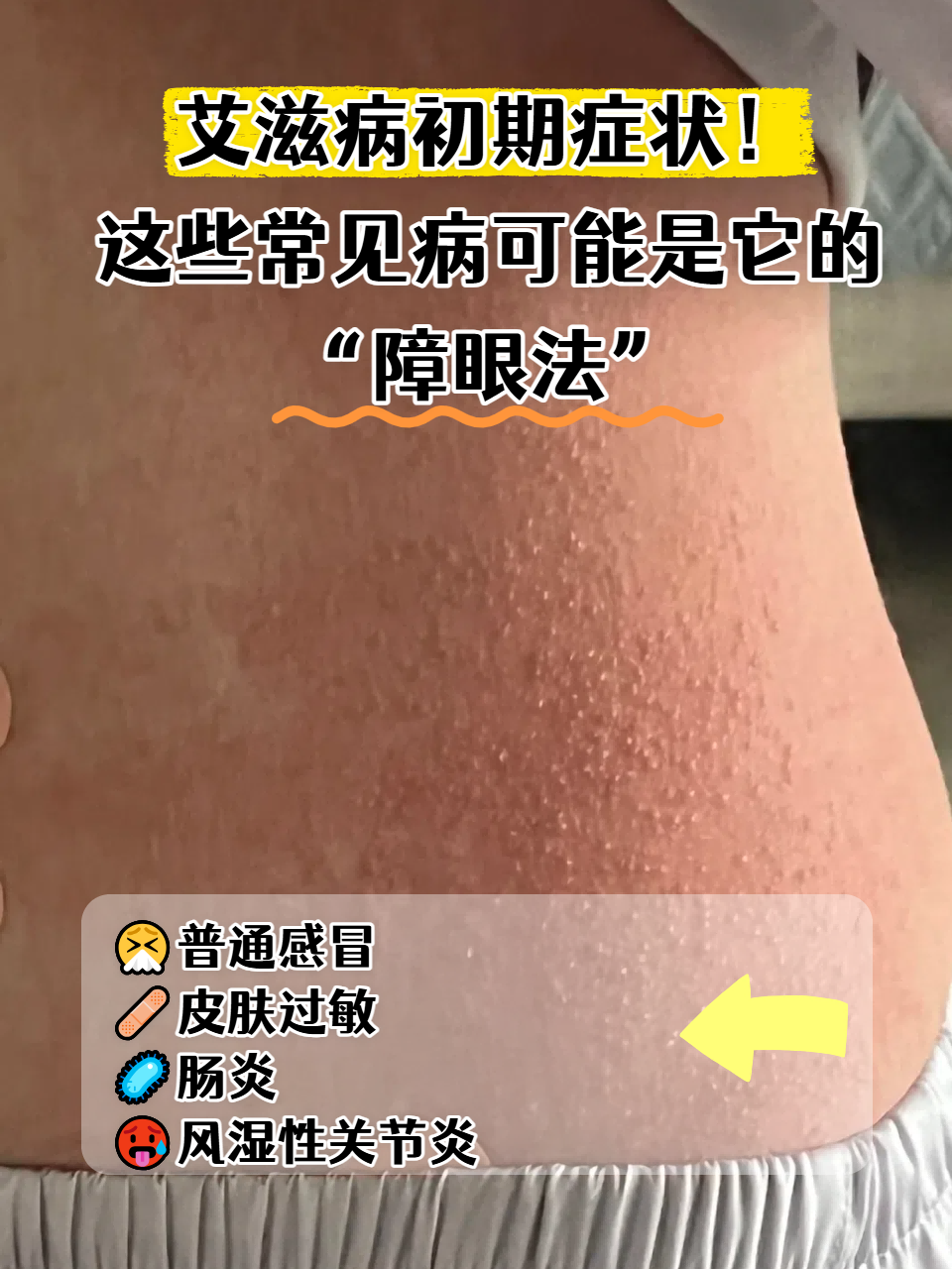 发现疫情的地区有哪些.发现疫情是什么症状？-第2张图片