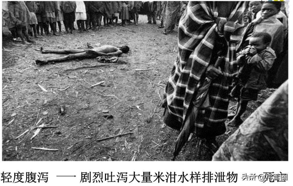 哪些地区出现霍乱疫情了(中国哪里还有发生霍乱)-第1张图片